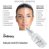 The Ordinary Salicylic Acid 2% Solution – 30 ml