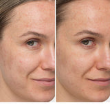 Confidence in a Cream Supercharged - Anti-Aging Hydrating Moisturizer - IT Cosmetics