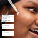 Glossier Super Glow Vitamin C Brightening Face Serum - 30 ml