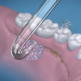 Waterpik Implant Denture Tip