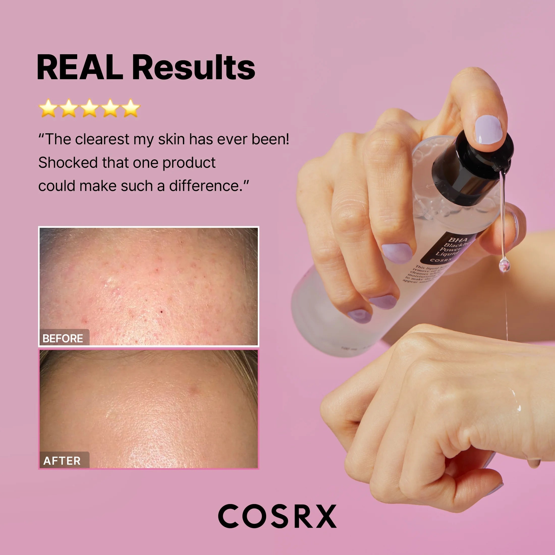 Cosrx BHA Blackhead Power Liquid - 50 ml